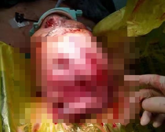 ▲四川宜賓女子遭到鄰居襲擊，頭破血流被扔下懸崖。（圖／翻攝自紅星新聞，下同）