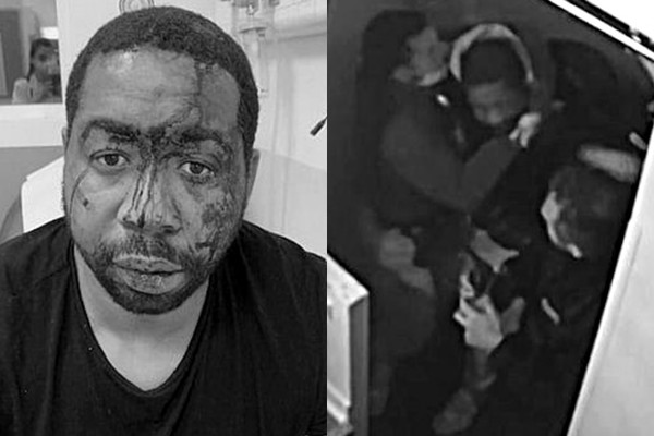 ▲▼法國非裔音樂製作人遭警察打到滿臉血。（圖／翻攝自推特）