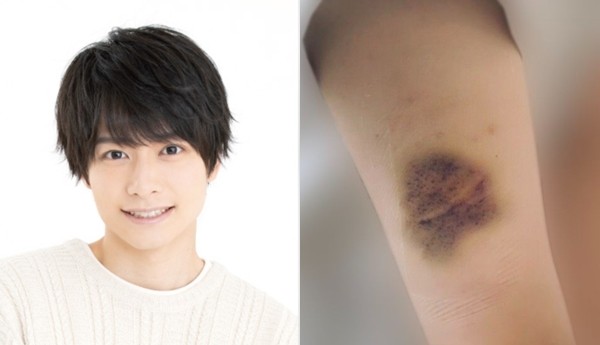 Ozawa Ren was accused of “domestic violence, forcing his girlfriend to have an abortion” and committed suicide!The company has a big voice: Cancel the contract immediately | ETtoday Xingguang Cloud | ETtoday News Cloud