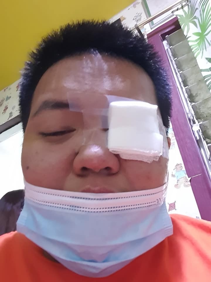 ▲▼菲律賓黑色鬆獅犬撞傷飼主眼角膜（圖／翻攝自Facebook／公開社團Woofing）