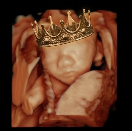 ▲林可彤懷胎5個多月，胎兒發育狀況驚人。（圖／翻攝自臉書／林可彤 Hope Lin）
