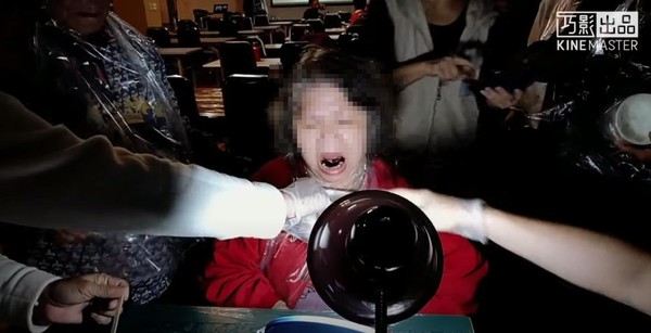 學員們將舌頭往上頂後，醫師拿刀在舌下靜脈處劃開兩道傷口，導致不少人當場流出滿口鮮血。（翻攝自YouTube）