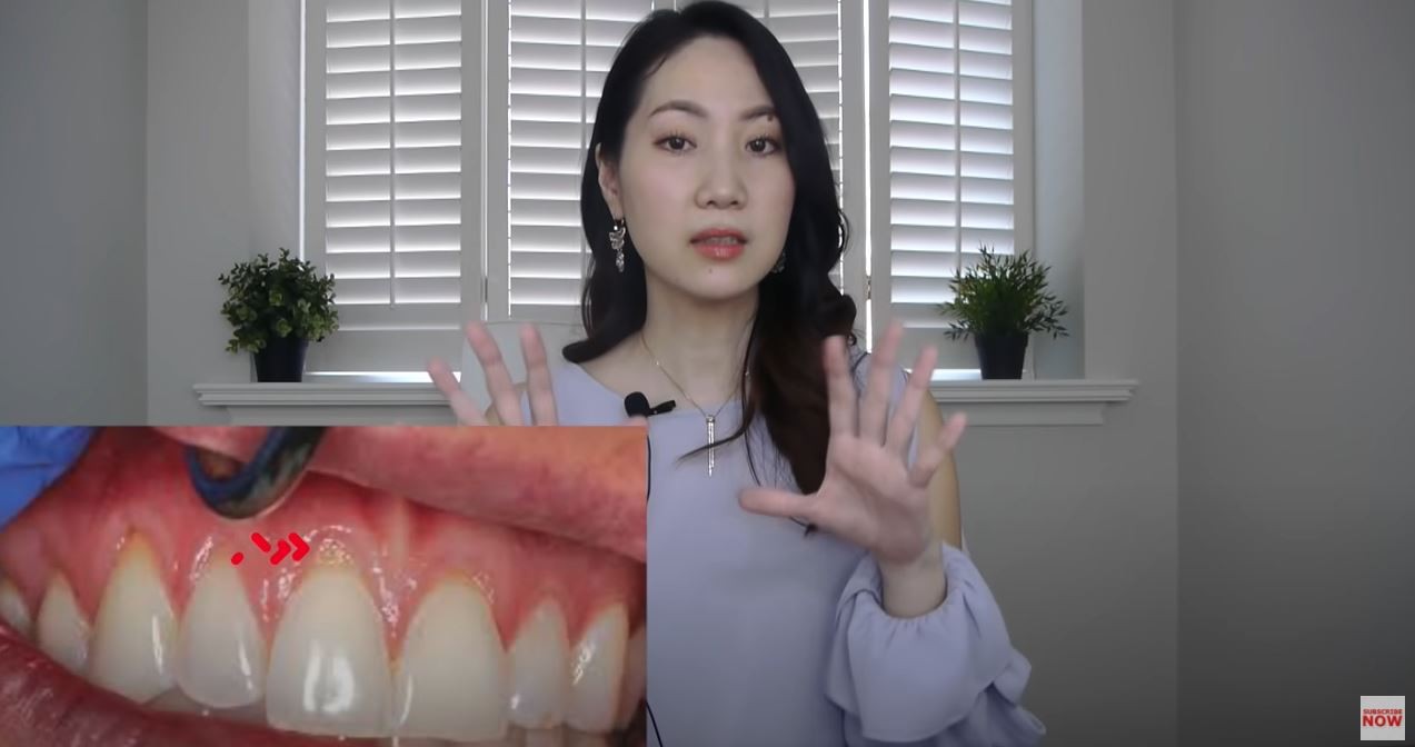 ▲▼美國牙醫師分享預防牙齦萎縮方法。（圖／翻攝自《Dr. Grace》Youtube頻道）