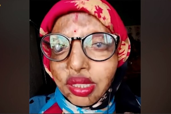 ▲▼印度女子魯爾（Pramodini Roul）遭潑酸毀容，如今找到真愛。（圖／翻攝自YouTube／Oddnaari）