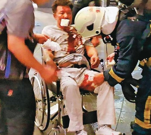 林英昌引爆炸彈後身受重傷，被送往醫院急救。（翻攝畫面）
