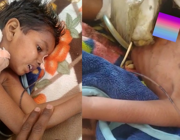 ▲印度一名3歲女童傷口未縫被趕出醫院死亡，引起外界關注。（圖／翻攝自Abhinav Pandey推特，下同）