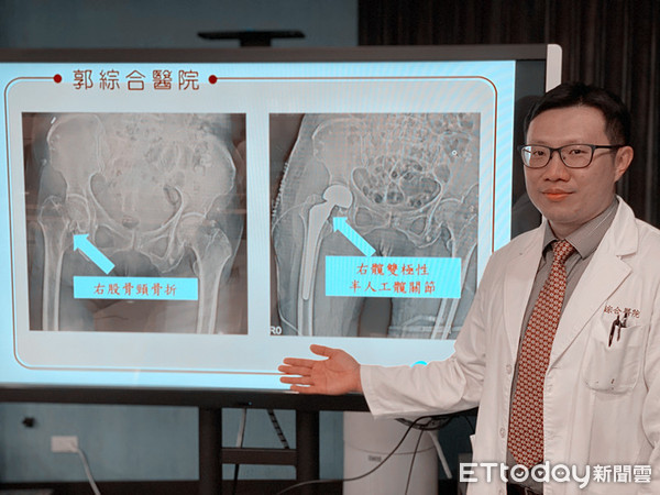 ▲郭綜合醫院骨科洪柏聖醫師指出，骨質疏鬆本身沒有直接症狀，一旦引起骨折，往往造成沉重的生命負擔，因此是一個沉默的殺手。（圖／記者林悅攝）