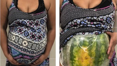 捧著西瓜裝懷孕！「孕肚太僵硬」路人越看越不對勁　報警挖出2kg毒品