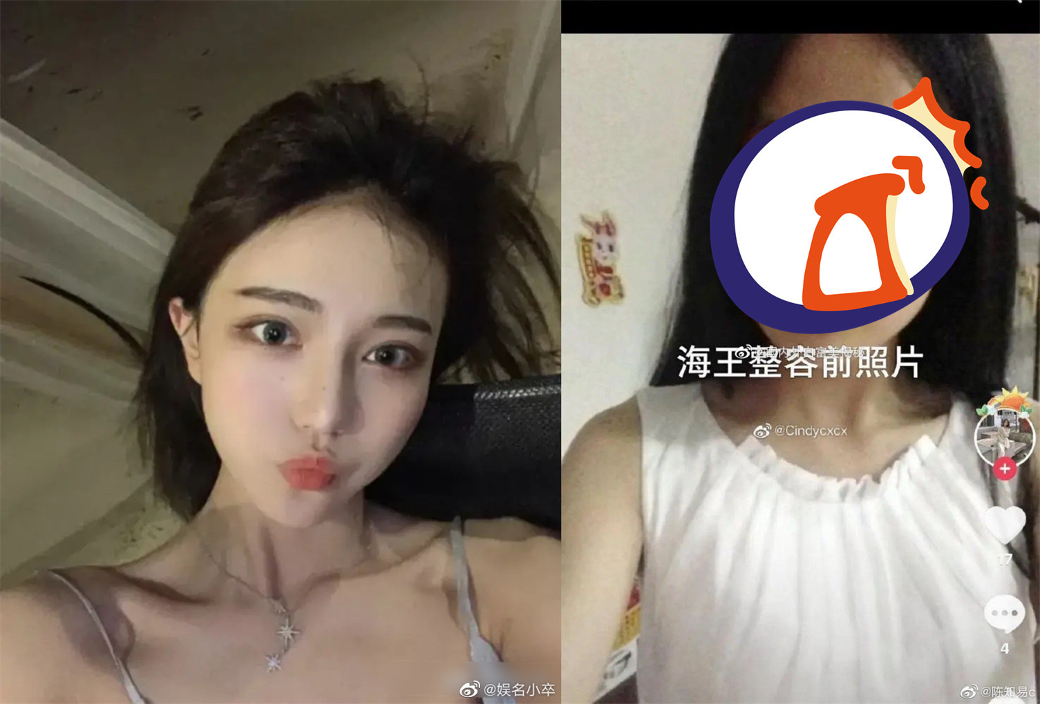 抖音女神「整型前模樣」曝！同睡5男被抓包富二代未婚夫原諒她| ETtoday大陸新聞| ETtoday新聞雲