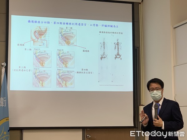 ▲▼ 國衛院攝護腺癌骨轉移利器     。（圖／記者嚴云岑攝）