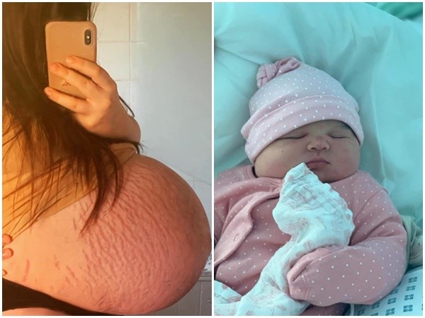 ▲英國新手媽媽生下近6公斤巨嬰。（圖／翻攝自Facebook／Amber Cumberland）