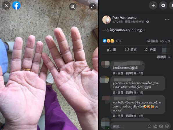 ▲▼郎祖筠臉書發皺雙手照，出自寮國醫護人員臉書。（圖／翻攝自臉書）