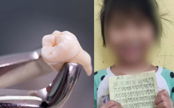 拔1顆牙賠上性命！5歲女童「血用噴的」離奇身亡　母心碎答應器捐。（圖／翻攝自微博／星視頻）