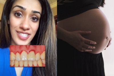 看牙齒能發現懷孕？牙科博士生談「臨床冷知識」：內分泌改變讓牙齦紅腫