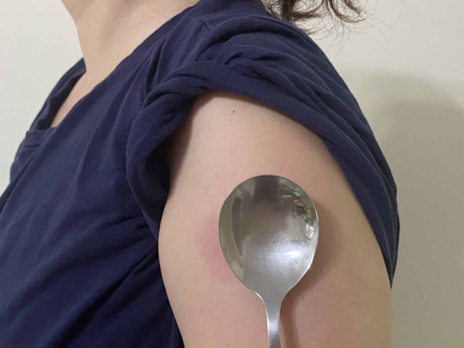 ▲▼讀者打完疫苗將湯匙放在手臂上，試試能不能黏住。（圖／讀者提供）