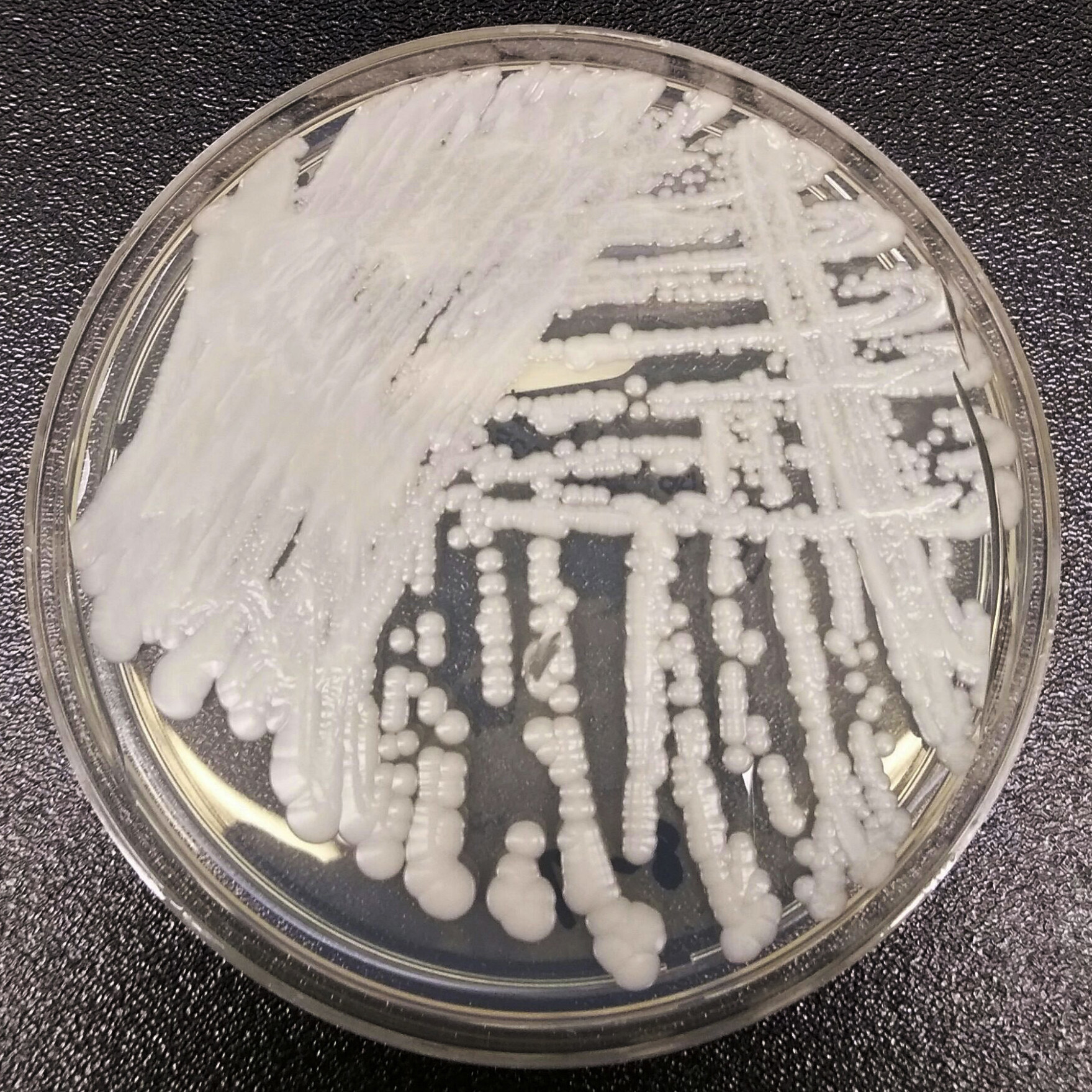 ▲▼ 美國CDC於2016年提供實驗室培養皿中的念珠菌照片。（圖／達志影像／美聯社）
