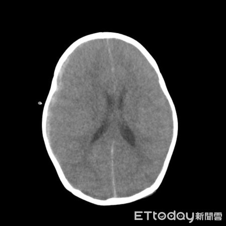 ▲▼女嬰受託保母照顧竟頭部外傷死亡，曾姓保母判8年。（圖／邱先生提供）