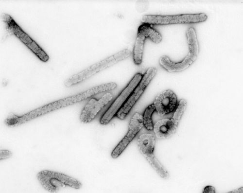 ▲▼顯微鏡下的馬堡病毒。（圖／取自美國CDC官網）