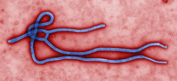 ▲▼伊波拉病毒。（圖／翻攝自美國CDC官網）
