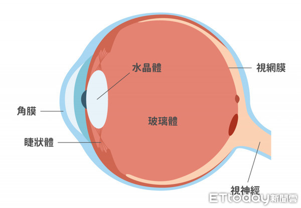 ▲玻璃體為玻尿酸與膠原纖維蛋白組成，玻尿酸可以吸收大量的水分，使眼球具有彈性，膠原纖維蛋白則為玻璃體的支柱。（圖／洪啟庭醫師提供）