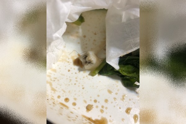 ▲湯裡有牙齒！台中女點UberEat外送喝綜合湯竟咬到「蛀牙」。（圖／投訴人提供）