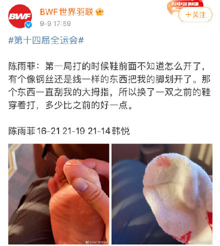 ▲奧運金牌穿「中國品牌球鞋」腳被割出血　代言人肖戰慘遭陸網出征。（圖／翻攝自微博／世界羽聯）