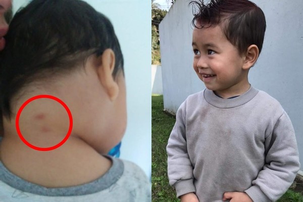 ▲▼2歲童疑被蜈蚣咬傷身亡。（圖／翻攝自Facebook／Marisete Dos Santos）