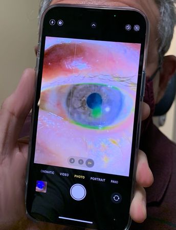 ▲▼美國醫生用iPhone 13 Pro相機檢查眼睛。（圖／翻攝自LinkedIn／Tommy Korn）