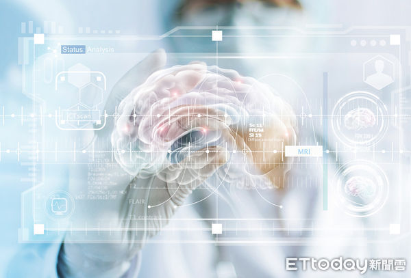 ▲順藥缺血性腦中風新藥，獲邀至WSC醫學會議發表。（圖／翻攝自順藥官網）