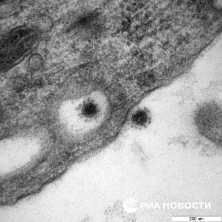 ▲▼俄羅斯「矢量」病毒與生物國家科學中心（VECTOR）公布Delta變異株的顯微鏡圖像。（圖／翻攝自VECTOR中心官網）