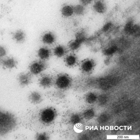 ▲▼俄羅斯「矢量」病毒與生物國家科學中心（VECTOR）公布Delta變異株的顯微鏡圖像。（圖／翻攝自VECTOR中心官網）