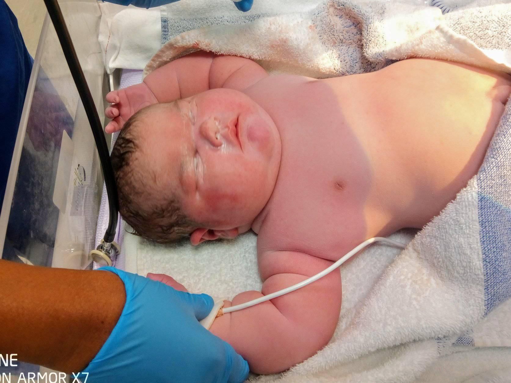 ▲▼ 雪兒（Cherral Mitchell）生下英國史上第三重巨嬰。（圖／翻攝自Facebook）