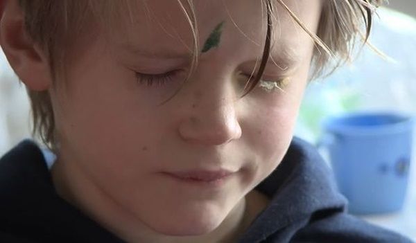 ▲▼粗心爸爸誤把強力膠當成眼藥膏，9歲小男孩眼睛黏住。（圖／翻攝Yorkshire Air Ambulance）