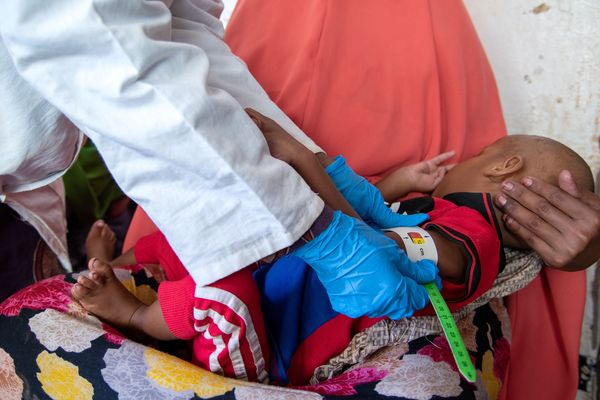 ▲▼世界展望會最新報告指出，疫情造成糧價飆漲，全球每分鐘11人死亡，已超越新冠肺炎致命人數。（圖／台灣世界展望會提供）