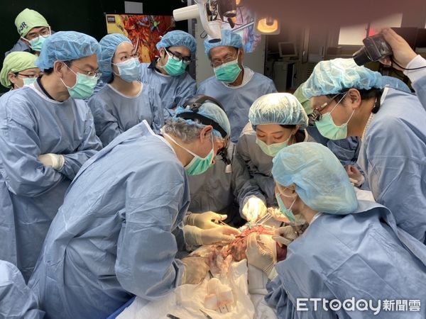▲高醫移植團隊邀請土耳其、新加坡整形外科教授來台進行變臉移植演練。（圖／高醫提供）