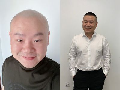36歲男星突變瘦 剃光頭 遭瘋傳病危 現身曝近況 屁股長瘤了 Iv Net I娛樂城