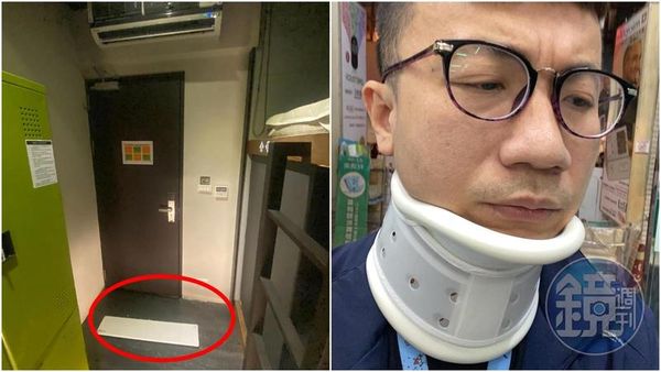 台語歌手黃大衛指控連鎖商旅的冷氣蓋板突然掉落，砸傷他的後腦和後頸。（讀者提供）