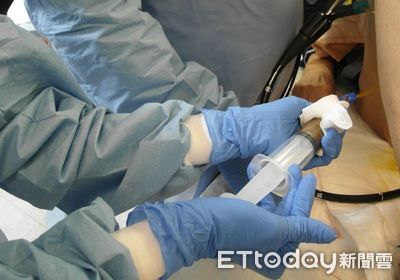 血癌媽骨隨移植「狂拉血便」險死 北榮植入「健康糞菌」救了她