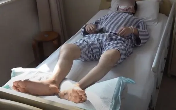 ▲▼3年不喝白開水　他30歲全身都生石。（圖／翻攝自微博）