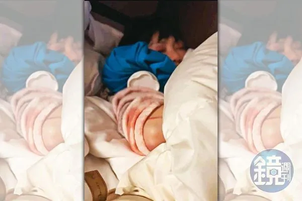 ▲▼【林秉樞成魔之路1】林秉樞惡魔暴行畫面獨家公開　高嘉瑜遭暴打眼眶瘀青慘照曝光。（圖／鏡週刊提供）