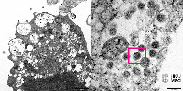 ▲香港大學公布的Omicron變種病毒顯微鏡下成像。（圖／翻攝澎湃新聞）