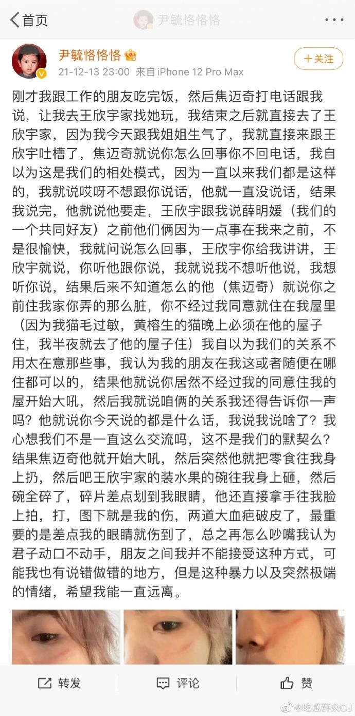 ▲▼尹毓恪指控被男友人施暴，打人的是歌手焦邁奇。（圖／翻攝自微博）