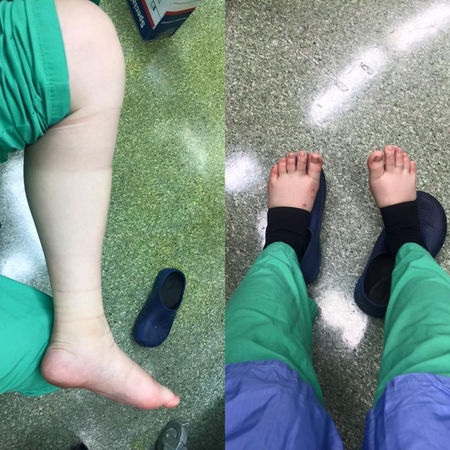 ▲▼吳欣岱醫師懷孕時開刀連站10多小時，雙腿嚴重浮腫（圖／翻攝自Facebook／吳欣岱）