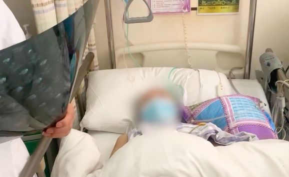 ▲▼ 左肩膀長足球大腫瘤。（圖／翻攝自秒拍）