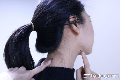 天生富貴命！命理師曝女人「3顆幸運痣」　長這裡魅力出眾又旺夫