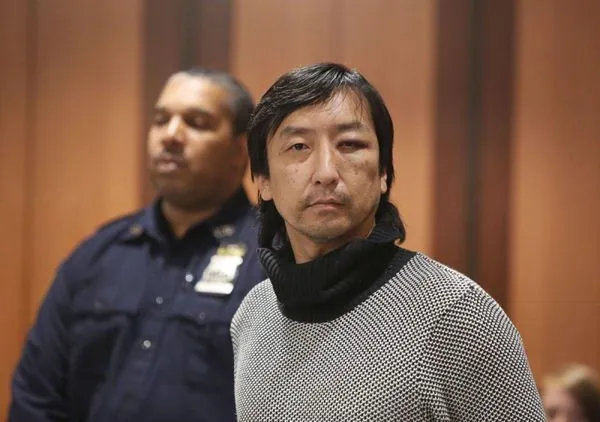 ▲▼金柱英被中國青年圍毆到眼角都是瘀傷。（圖／翻攝自韓網）