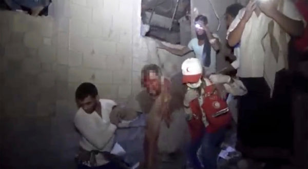 ▲▼沙烏地阿拉伯空襲葉門造成至少70人死亡，生還者滿臉是血。（圖／達志影像／美聯社）