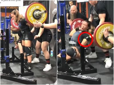 驚悚影片曝!她蹲舉167kg瞬間斷臂 啪一聲「骨頭試圖刺穿皮膚」