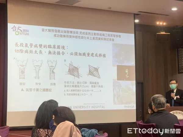 ▲▼亞洲首例！台大醫院用主動脈「種出氣管」　44歲男已可快走不會喘。（圖／記者嚴云岑攝）