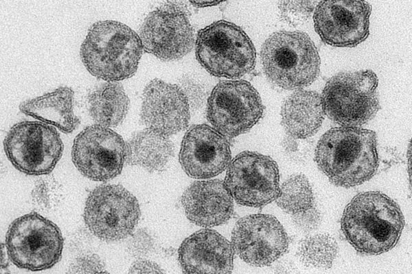 ▲▼ 美國疾管中心2011年的HIV病毒粒子電子顯微鏡影像。（圖／達志影像／美聯社）